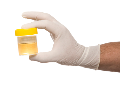 Drug Testing Urine